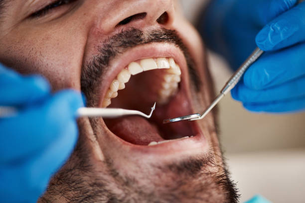 Best Emergency Broken Tooth Repair in New Boston, TX